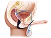 Stimulátor prostaty s kroužkem na penis elastický